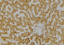 ITPA Antibody - 1:100 staining mouse liver tissue by IHC-P. The sample was formaldehyde fixed and a heat mediated antigen retrieval step in citrate buffer was performed. The sample was then blocked and incubated with the antibody for 1.5 hours at 22°C. An HRP conjugated goat anti-rabbit antibody was used as the secondary.