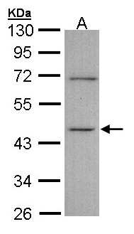 ITPK1 Antibody - Sample (30 ug of whole cell lysate). A: A431 . 10% SDS PAGE. ITPK1 antibody diluted at 1:1000