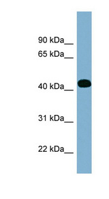 ITPK1 Antibody - ITPK1 antibody Western blot of Fetal Spleen lysate. This image was taken for the unconjugated form of this product. Other forms have not been tested.