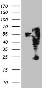 ITPK1 Antibody - HEK293T cells were transfected with the pCMV6-ENTRY control. (Left lane) or pCMV6-ENTRY ITPK1. (Right lane) cDNA for 48 hrs and lysed. Equivalent amounts of cell lysates. (5 ug per lane) were separated by SDS-PAGE and immunoblotted with anti-ITPK1. (1:2000)