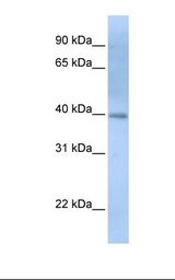 ITPK1 Antibody - Fetal heart lysate. Antibody concentration: 1.0 ug/ml. Gel concentration: 12%.  This image was taken for the unconjugated form of this product. Other forms have not been tested.