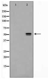 ITPK1 Antibody - Western blot of HeLa cell lysate using ITPK1 Antibody