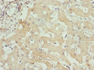 ITPK1 Antibody - Immunohistochemistry of paraffin-embedded human liver tissue at dilution 1:100