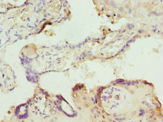 ITPK1 Antibody - Immunohistochemistry of paraffin-embedded human placenta tissue at dilution 1:100