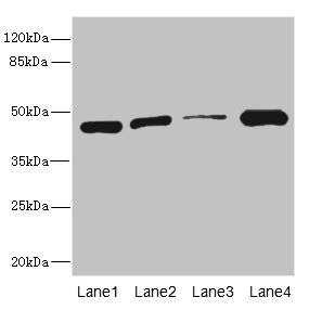 ITPK1 Antibody - Western blot All Lanes: ITPK1antibody at 3.58ug/ml Lane 1 : Hela whole cell lysate Lane 2 : HepG-2 whole cell lysate Lane 3 : Mouse gonadal tissue Lane 4 : A431 whole cell lysate Secondary Goat polyclonal to Rabbit IgG at 1/10000 dilution Predicted band size: 46,36 kDa Observed band size: 46 kDa