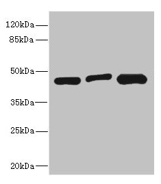 ITPK1 Antibody - Western blot All lanes: ITPK1 antibody at 3.58µg/ml Lane 1: Hela whole cell lysate Lane 2: HepG2 whole cell lysate Lane 3: A431 whole cell lysate Secondary Goat polyclonal to rabbit IgG at 1/10000 dilution Predicted band size: 46, 36 kDa Observed band size: 46 kDa
