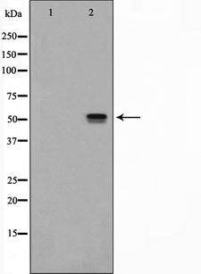 ITPK1 Antibody - Western blot analysis on HeLa cell lysates using ITPK1 antibody. The lane on the left is treated with the antigen-specific peptide.