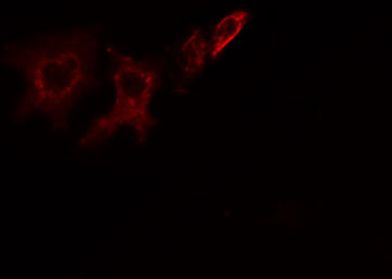 ITPK1 Antibody - Staining HeLa cells by IF/ICC. The samples were fixed with PFA and permeabilized in 0.1% Triton X-100, then blocked in 10% serum for 45 min at 25°C. The primary antibody was diluted at 1:200 and incubated with the sample for 1 hour at 37°C. An Alexa Fluor 594 conjugated goat anti-rabbit IgG (H+L) antibody, diluted at 1/600, was used as secondary antibody.