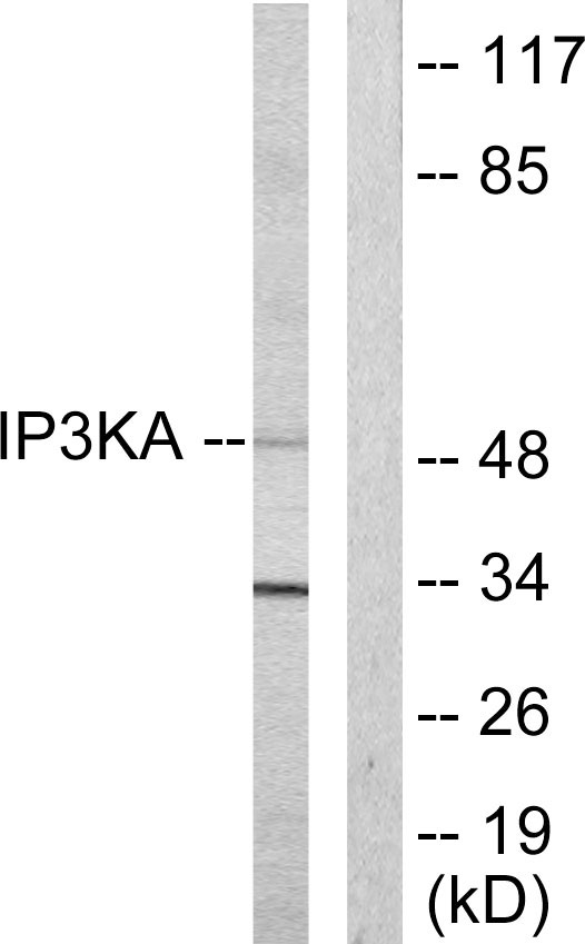 ITPKA Antibody - Western blot analysis of lysates from HUVEC cells, using IP3KA Antibody. The lane on the right is blocked with the synthesized peptide.