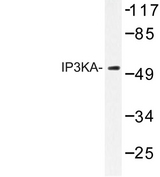 ITPKA Antibody - Western blot of IP3KA (H431) pAb in extracts from HuvEc cells.