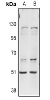 ITPKA Antibody - Western blot analysis of ITPKA expression in A549 (A), LO2 (B) whole cell lysates.