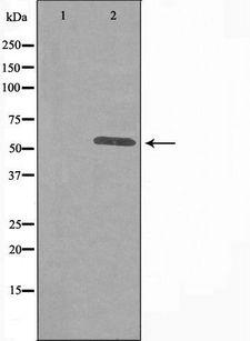 ITPKA Antibody - Western blot analysis of extracts of HuvEc cells using IP3KA antibody. The lane on the left is treated with the antigen-specific peptide.