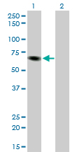 ITPKB Antibody - Western Blot analysis of ITPKB expression in transfected 293T cell line by ITPKB monoclonal antibody (M01), clone 2F8.Lane 1: ITPKB transfected lysate(67.4 KDa).Lane 2: Non-transfected lysate.