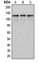 ITPKB Antibody - Western blot analysis of ITPKB expression in HeLa (A); SP2/0 (B); H9C2 (C) whole cell lysates.