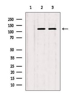 ITPKB Antibody - Western blot analysis of extracts of various samples using IP3KB antibody. Lane 1: 293 treated with blocking peptide; Lane 2: 293; Lane 3: HeLa;