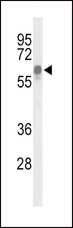 ITPKC Antibody - Western blot of ITPKC Antibody in HepG2 cell line lysates (35 ug/lane). ITPKC (arrow) was detected using the purified antibody.