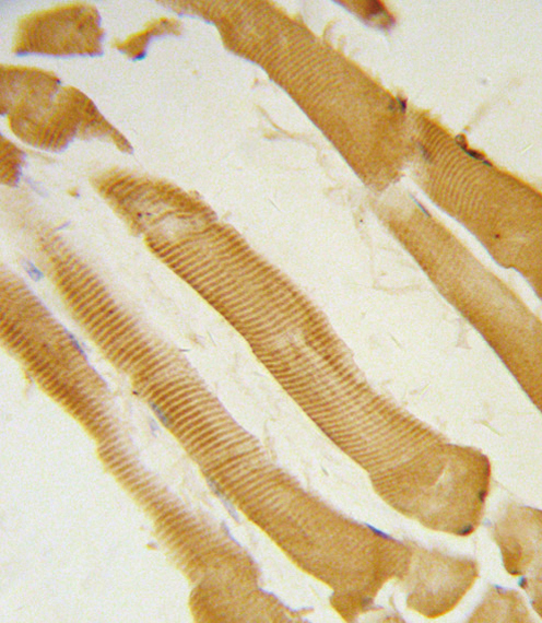 ITPKC Antibody - Formalin-fixed and paraffin-embedded human skeletal muscle reacted with ITPKC Antibody , which was peroxidase-conjugated to the secondary antibody, followed by DAB staining. This data demonstrates the use of this antibody for immunohistochemistry; clinical relevance has not been evaluated.