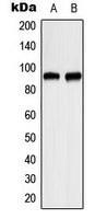 ITPKC Antibody - Western blot analysis of ITPKC expression in HeLa (A); RT4 (B) whole cell lysates.