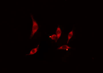 ITPKC Antibody - Staining HT29 cells by IF/ICC. The samples were fixed with PFA and permeabilized in 0.1% Triton X-100, then blocked in 10% serum for 45 min at 25°C. The primary antibody was diluted at 1:200 and incubated with the sample for 1 hour at 37°C. An Alexa Fluor 594 conjugated goat anti-rabbit IgG (H+L) antibody, diluted at 1/600, was used as secondary antibody.