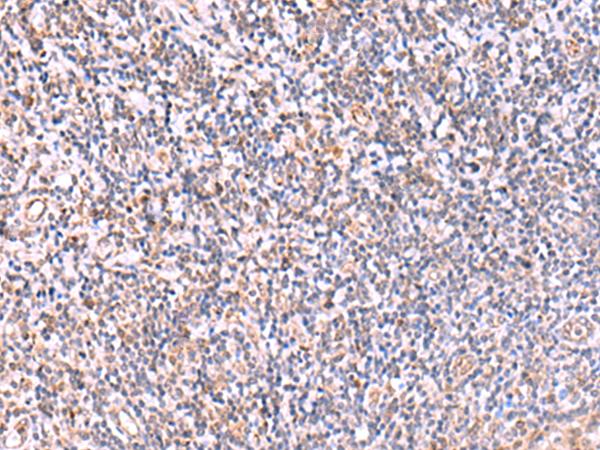 ITPKC Antibody - Immunohistochemistry of paraffin-embedded Human tonsil tissue  using ITPKC Polyclonal Antibody at dilution of 1:40(×200)