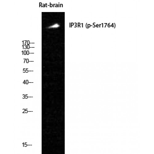 ITPR1 / IP3 Receptor Type 1 Antibody - Western blot of Phospho-IP3R-I (S1764) antibody
