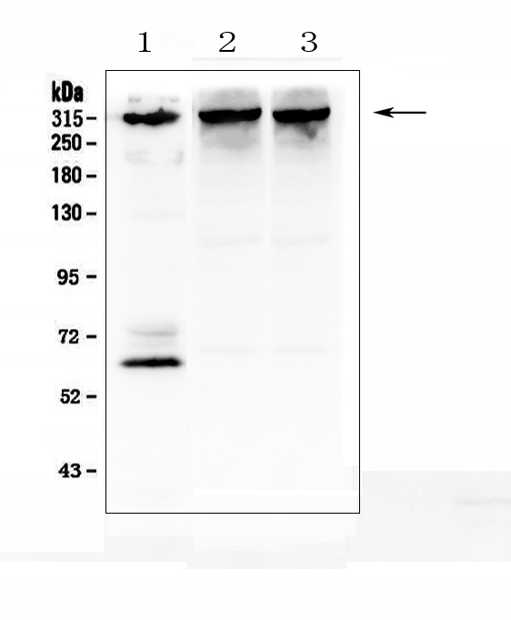 ITPR1 / IP3 Receptor Type 1 Antibody - Western blot analysis of IP3 Receptor using anti-IP3 Receptor antibody. Electrophoresis was performed on a 5-20% SDS-PAGE gel at 70V (Stacking gel) / 90V (Resolving gel) for 2-3 hours. The sample well of each lane was loaded with 50ug of sample under reducing conditions. Lane 1: human SHG-44 whole cell lysates, Lane 2: rat brain tissue lysates, Lane 3: mouse brain tissue lysates, After Electrophoresis, proteins were transferred to a Nitrocellulose membrane at 150mA for 50-90 minutes. Blocked the membrane with 5% Non-fat Milk/ TBS for 1.5 hour at RT. The membrane was incubated with rabbit anti-IP3 Receptor antigen affinity purified polyclonal antibody at 0.5 µg/mL overnight at 4°C, then washed with TBS-0.1% Tween 3 times with 5 minutes each and probed with a goat anti-rabbit IgG-HRP secondary antibody at a dilution of 1:10000 for 1.5 hour at RT. The signal is developed using an Enhanced Chemiluminescent detection (ECL) kit with Tanon 5200 system. A specific band was detected for IP3 Receptor at approximately 315KD. The expected band size for IP3 Receptor is at 315KD.