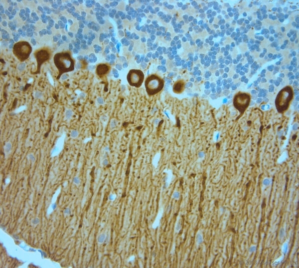 ITPR1 / IP3 Receptor Type 1 Antibody - Rabbit antibody to IP3R 1 (700-750). IHC-P on paraffin sections of rat cerebellum. The animal was perfused using Autoperfuser at a pressure of 110 mm Hg with 300 ml 4% FA and further post fixed overnight before being processed for paraffin embedding. HIER: Tris-EDTA, pH 9 for 20 min using Thermo PT Module. Blocking: 0.2% LFDM in TBST filtered through a 0.2 micron filter. Detection was done using Novolink HRP polymer from Leica following manufacturers instructions. Primary antibody: dilution 1:1000, incubated 30 min at RT (using Autostainer). Sections were counterstained with Harris Hematoxylin.