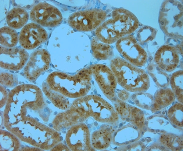 ITPR1 / IP3 Receptor Type 1 Antibody - Rabbit antibody to IP3R 1 (700-750). IHC-P on paraffin sections of rat kidney. The animal was perfused using Autoperfuser at a pressure of 110 mm Hg with 300 ml 4% FA and further post fixed overnight before being processed for paraffin embedding. HIER: Tris-EDTA, pH 9 for 20 min using Thermo PT Module. Blocking: 0.2% LFDM in TBST filtered through a 0.2 micron filter. Detection was done using Novolink HRP polymer from Leica following manufacturers instructions. Primary antibody: dilution 1:1000, incubated 30 min at RT (using Autostainer). Sections were counterstained with Harris Hematoxylin.