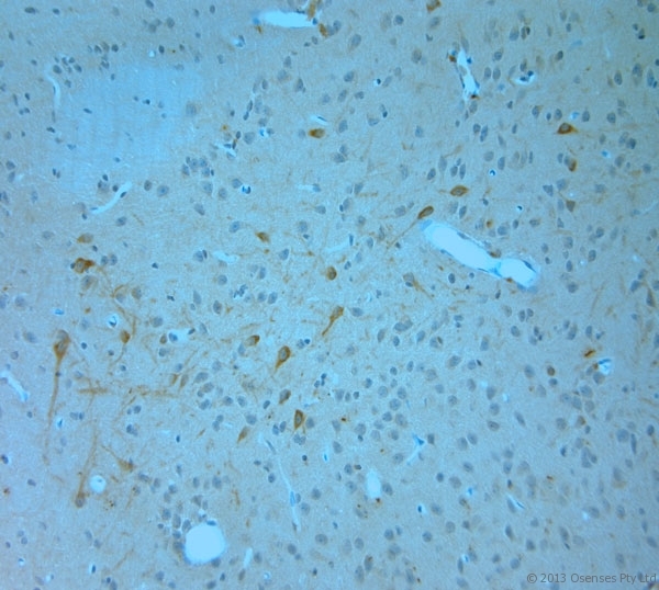ITPR1 / IP3 Receptor Type 1 Antibody - Rabbit antibody to IP3R 1 (700-750). IHC-P on paraffin sections of rat brain. The animal was perfused using Autoperfuser at a pressure of 110 mm Hg with 300 ml 4% FA and further post fixed overnight before being processed for paraffin embedding. HIER: Tris-EDTA, pH 9 for 20 min using Thermo PT Module. Blocking: 0.2% LFDM in TBST filtered through a 0.2 micron filter. Detection was done using Novolink HRP polymer from Leica following manufacturers instructions. Primary antibody: dilution 1:1000, incubated 30 min at RT (using Autostainer). Sections were counterstained with Harris Hematoxylin.