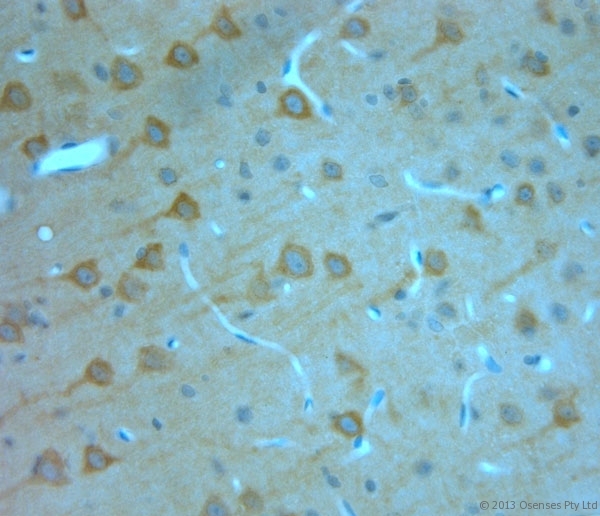 ITPR1 / IP3 Receptor Type 1 Antibody - Rabbit antibody to IP3R 1 (700-750). IHC-P on paraffin sections of rat brain. The animal was perfused using Autoperfuser at a pressure of 110 mm Hg with 300 ml 4% FA and further post fixed overnight before being processed for paraffin embedding. HIER: Tris-EDTA, pH 9 for 20 min using Thermo PT Module. Blocking: 0.2% LFDM in TBST filtered through a 0.2 micron filter. Detection was done using Novolink HRP polymer from Leica following manufacturers instructions. Primary antibody: dilution 1:1000, incubated 30 min at RT (using Autostainer). Sections were counterstained with Harris Hematoxylin.