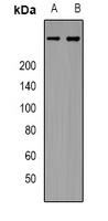 ITPR1 / IP3 Receptor Type 1 Antibody - Western blot analysis of IP3R expression in HeLa (A); HEK293T (B) whole cell lysates.