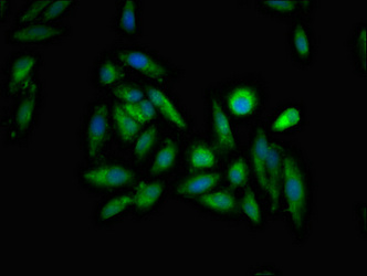 ITPR1 / IP3 Receptor Type 1 Antibody - Immunofluorescent analysis of Hela cells at a dilution of 1:100 and Alexa Fluor 488-congugated AffiniPure Goat Anti-Rabbit IgG(H+L)
