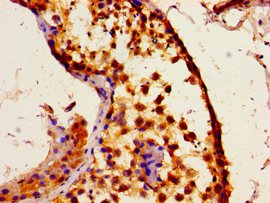 ITPR1 / IP3 Receptor Type 1 Antibody - Immunohistochemistry image of paraffin-embedded human testis tissue at a dilution of 1:100