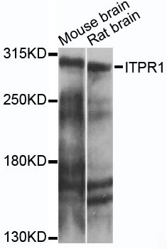 ITPR1 / IP3 Receptor Type 1 Antibody - Western blot analysis of extracts of various cell lines, using ITPR1 antibody at 1:1000 dilution. The secondary antibody used was an HRP Goat Anti-Rabbit IgG (H+L) at 1:10000 dilution. Lysates were loaded 25ug per lane and 3% nonfat dry milk in TBST was used for blocking. An ECL Kit was used for detection and the exposure time was 10s.