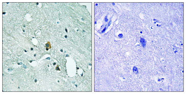 ITPR1 / IP3 Receptor Type 1 Antibody - Immunohistochemistry analysis of paraffin-embedded human brain, using IP3R1 (Phospho-Ser1764) Antibody. The picture on the right is blocked with the phospho peptide.