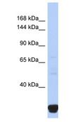 ITPR2 / IP3 Receptor Type 2 Antibody - ITPR2 / IP3 Receptor antibody Western Blot of Fetal Small Intestine. Antibody dilution: 1 ug/ml.  This image was taken for the unconjugated form of this product. Other forms have not been tested.