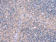 ITPR2 / IP3 Receptor Type 2 Antibody - Immunohistochemistry of paraffin-embedded Human tonsil tissue  using ITPR2 Polyclonal Antibody at dilution of 1:65(×200)