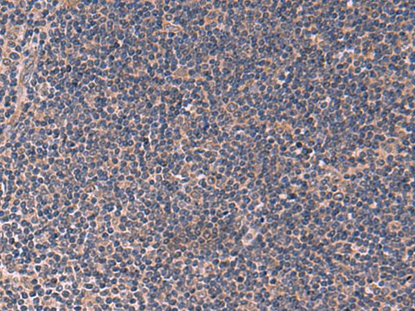 ITPR2 / IP3 Receptor Type 2 Antibody - Immunohistochemistry of paraffin-embedded Human tonsil tissue  using ITPR2 Polyclonal Antibody at dilution of 1:60(×200)