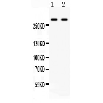 ITPR3 Antibody - ITPR3 antibody Western blot. All lanes: Anti ITPR3 at 0.5 ug/ml. Lane 1: HELA Whole Cell Lysate at 40 ug. Lane 2: SW620 Whole Cell Lysate at 40 ug. Predicted band size: 304 kD. Observed band size: 304 kD.
