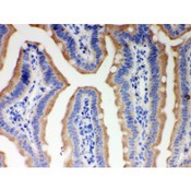 ITPR3 Antibody - ITPR3 antibody IHC-paraffin. IHC(P): Mouse Intestine Tissue.