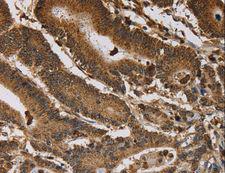 ITPR3 Antibody - Immunohistochemistry of paraffin-embedded Human brain using ITPR3 Polyclonal Antibody at dilution of 1:40.