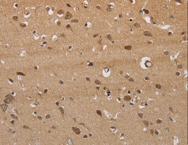 ITPR3 Antibody - Immunohistochemistry of paraffin-embedded Human brain using ITPR3 Polyclonal Antibody at dilution of 1:40.