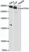 ITPR3 Antibody - Western blot analysis of extracts of various cell lines, using ITPR3 antibody at 1:3000 dilution. The secondary antibody used was an HRP Goat Anti-Rabbit IgG (H+L) at 1:10000 dilution. Lysates were loaded 25ug per lane and 3% nonfat dry milk in TBST was used for blocking. An ECL Kit was used for detection and the exposure time was 90s.