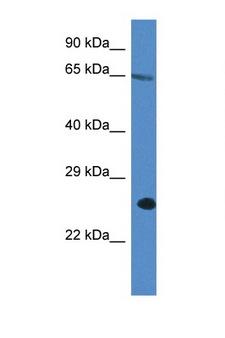 ITPRIP Antibody - ITPRIP antibody Western blot of A549 Cell lysate. Antibody concentration 1 ug/ml.  This image was taken for the unconjugated form of this product. Other forms have not been tested.