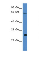 ITPRIP Antibody - ITPRIP antibody Western blot of A549 Cell lysate. Antibody concentration 1 ug/ml.  This image was taken for the unconjugated form of this product. Other forms have not been tested.