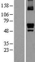 ITPRIP Protein - Western validation with an anti-DDK antibody * L: Control HEK293 lysate R: Over-expression lysate