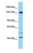 ITSN2 Antibody - ITSN2 antibody Western Blot of HepG2.  This image was taken for the unconjugated form of this product. Other forms have not been tested.