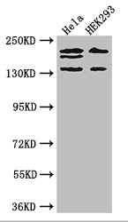ITSN2 Antibody - Positive WB detected in:Hela whole cell lysate,HEK293 whole cell lysate;All lanes: ITSN2 antibody at 4ug/ml;Secondary;Goat polyclonal to rabbit IgG at 1/50000 dilution;Predicted band size: 194,191,142,136 kDa;Observed band size: 194,191,142 kDa;