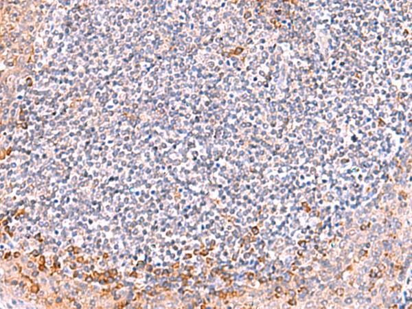 ITSN2 Antibody - Immunohistochemistry of paraffin-embedded Human tonsil tissue  using ITSN2 Polyclonal Antibody at dilution of 1:40(×200)