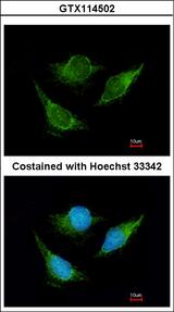 IVD Antibody - Immunofluorescence of methanol-fixed HeLa using IVD antibody at 1:200 dilution.